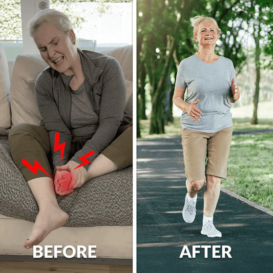 Top 5 Mistakes People Make When Using Magnesium Cream for Leg Pain